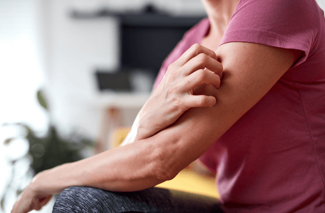 Relieve Menopause Itchy Skin with These Tips